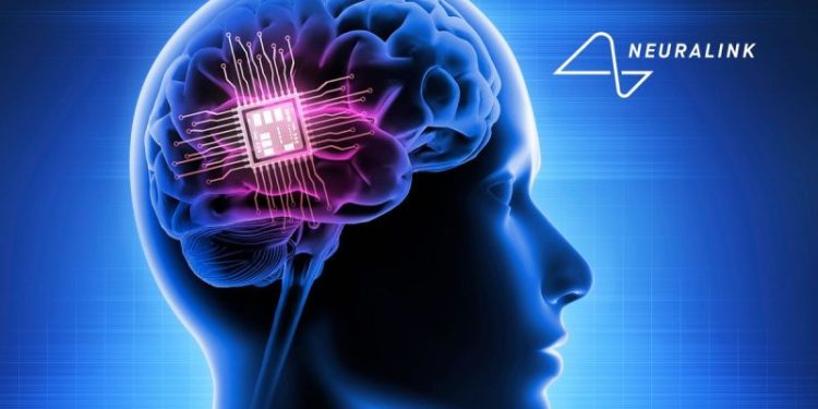 Can You Invest in Elon Musk’s Neuralink?