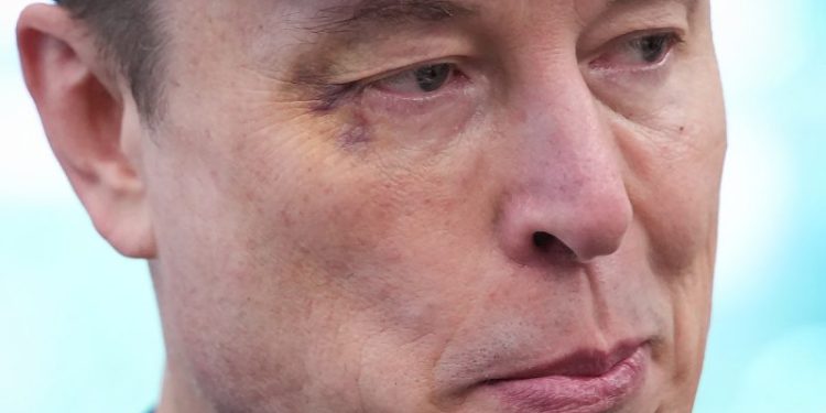 Elon Musk sports black eye at farewell presser in Oval Office: ‘Horsing around with little X’